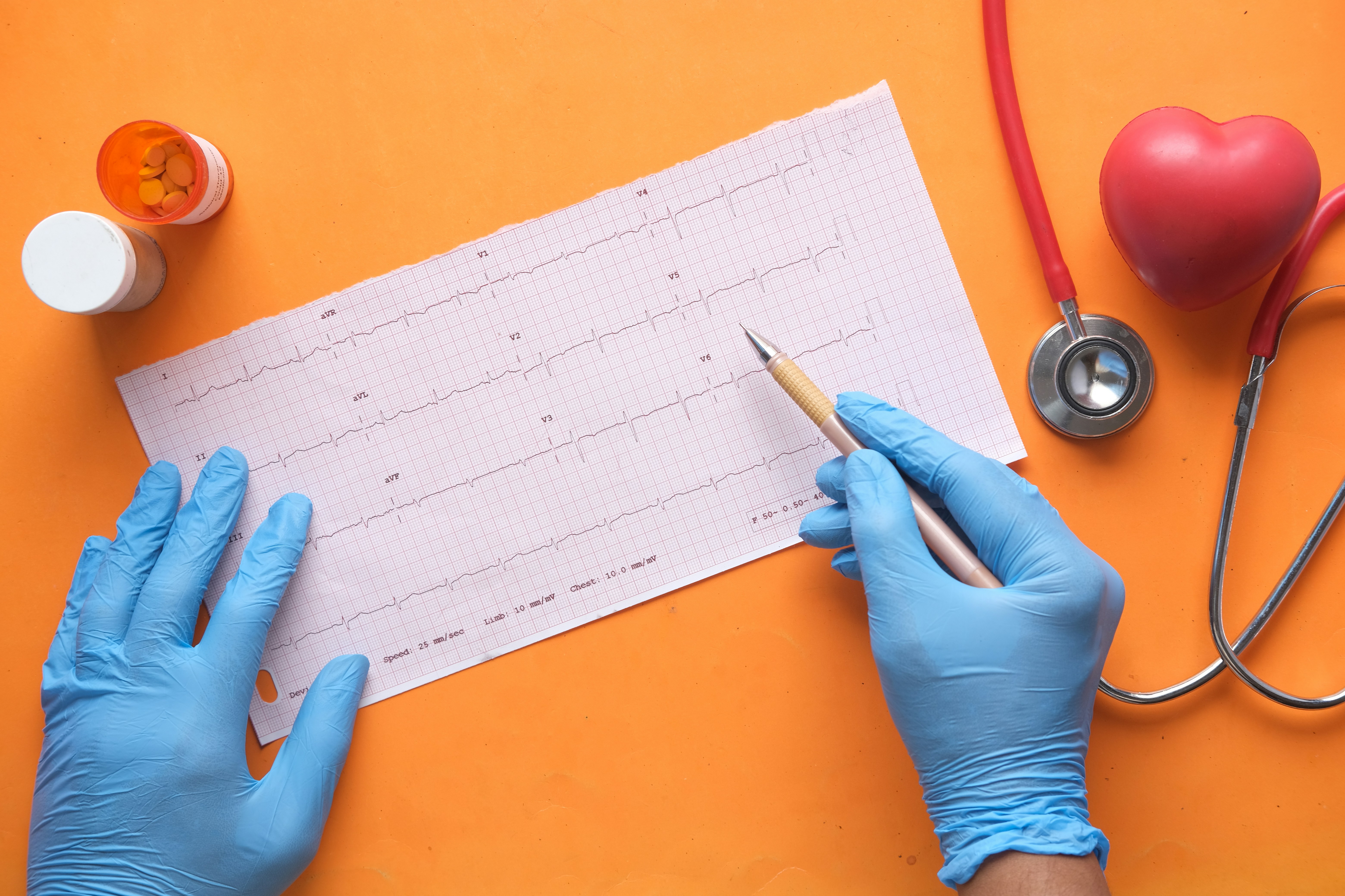 EKG Photo by Towfiqu barbhuiya on Unsplash